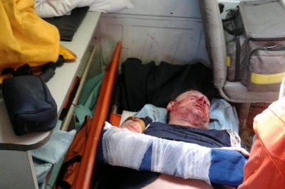 Побиття Олега Філіпаса