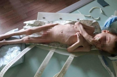 Батьки морили хлопчика голодом