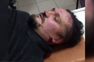 Побили Сергія Мазуренка