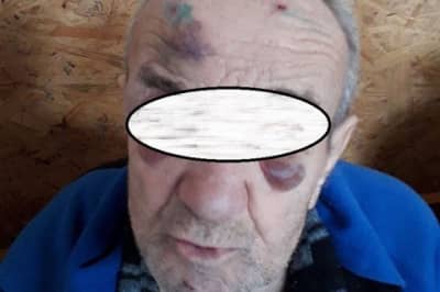 Підопічний у Стародобровільському психоневрологічному інтернаті