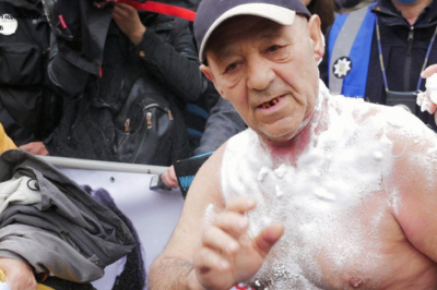 Чоловік вчинив самопідпал