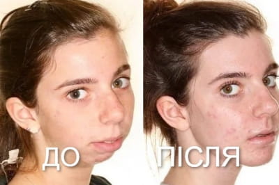 До - Після