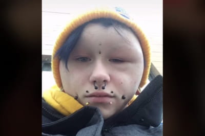 Реакция на краску для волос