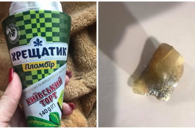 Зуб у морозиві