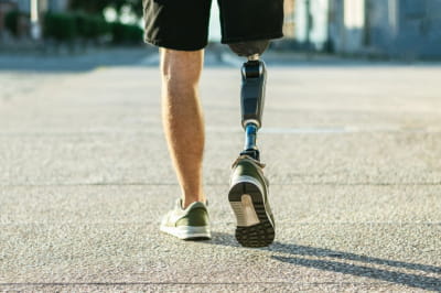 Людина з однією ногою