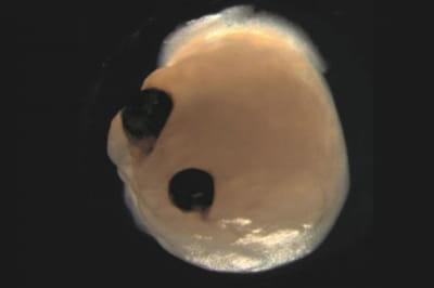 Німецькі вчені "виростили" міні-версію людського мозку з очима