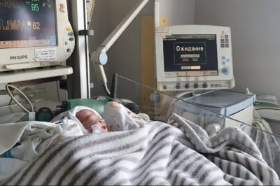 У Києві лікарі провели операцію дівчинці, вагою у 1,5 кг