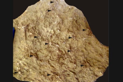 Викопні рештки