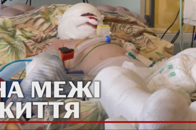 Потерпілий хлопчик