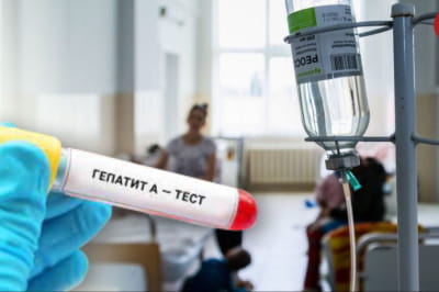 гепатит А