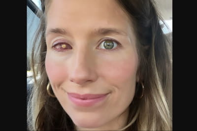 Рейчел Прохнов