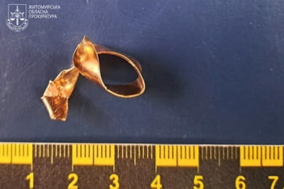 Объявлено подозрение судмедэксперту