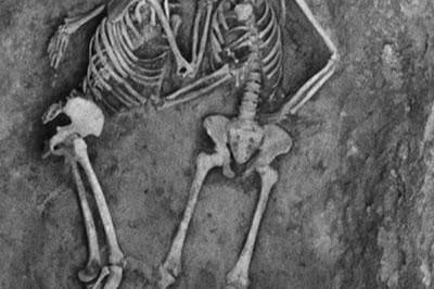 «Влюбленные Хасанлу», скончавшиеся около 800 года до нашей эры, были обнаружены в 1973 году. Их останки были найдены в тесных объятиях или поцелуях, которые они хранили почти 2800 лет.