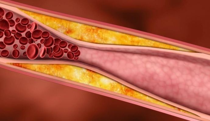 Холестерин