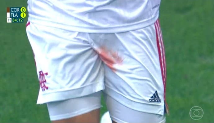 Травмований Густаво Енріке