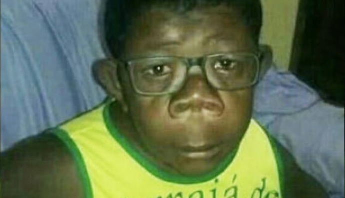 хлопчик, який народився від людини та шимпанзе