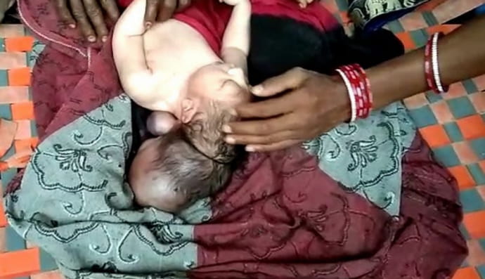 Дитина з трьома головами