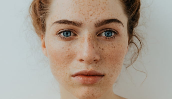 Веснушки, лицо, женщина, девушка