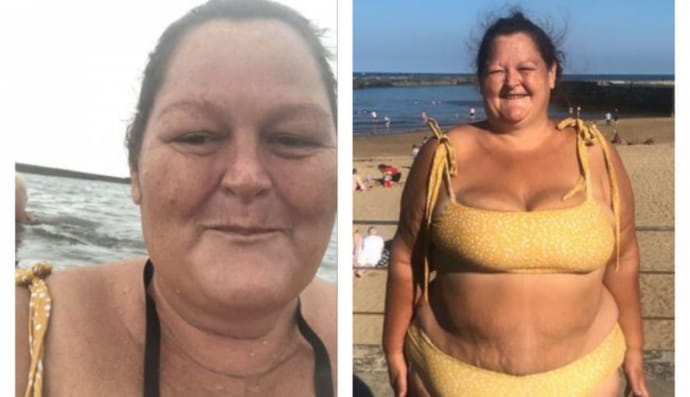 Жінка схудла на 101 кг