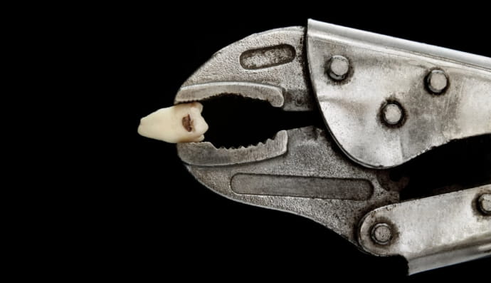 Вырванный зуб