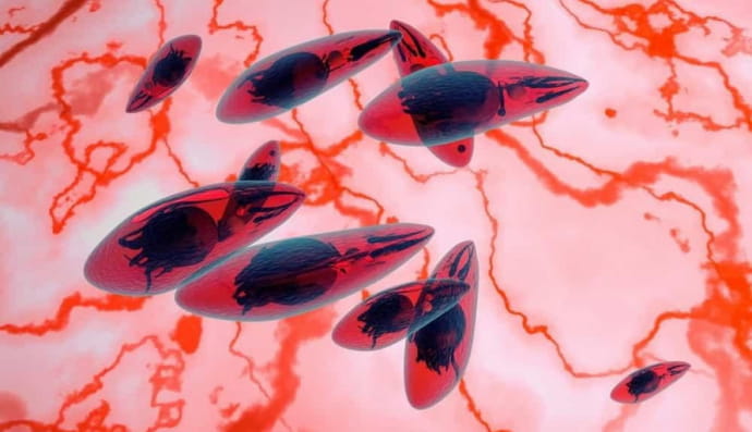 Токсоплазма