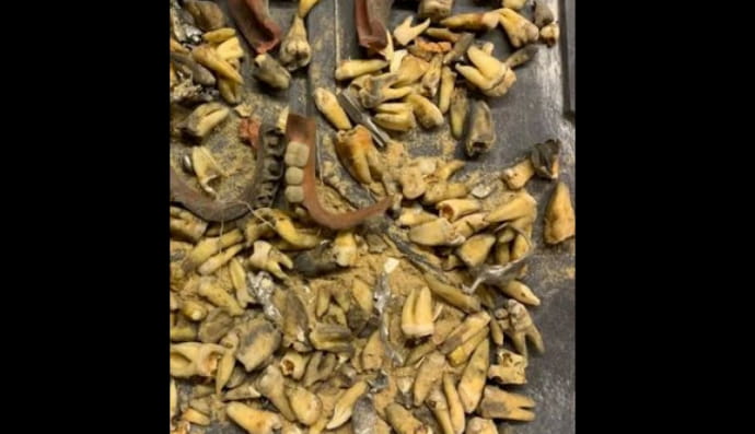 Гнилые зубы