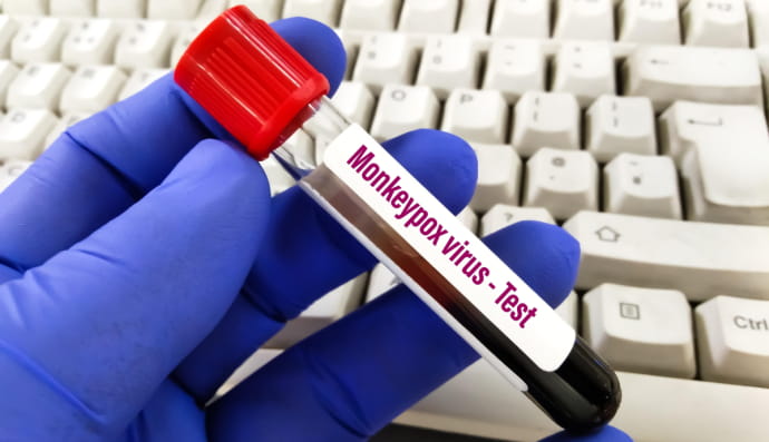 Мавпяча віспа