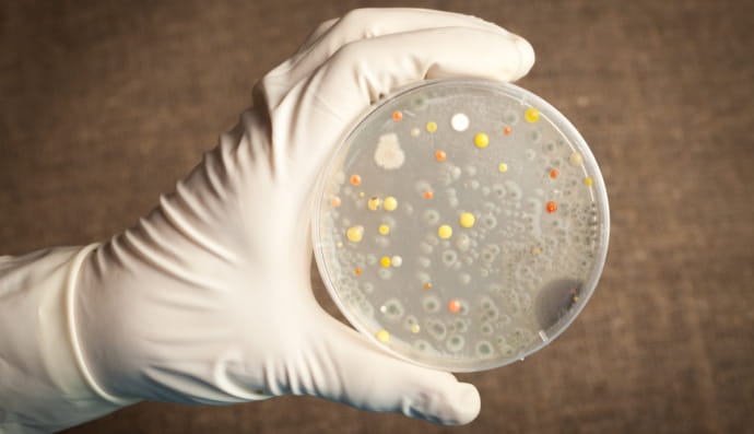 сибірська виразка