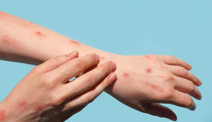 подразнення