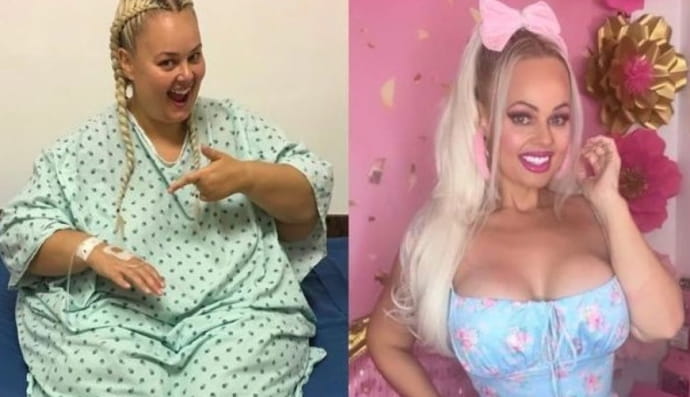 Жінка схудла на 90 кг завдяки польоту на літаку