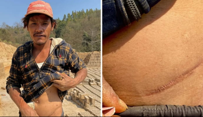 Трансплантация