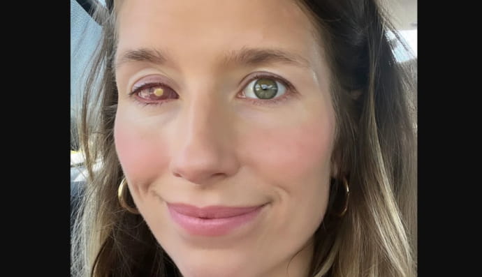 Рейчел Прохнов