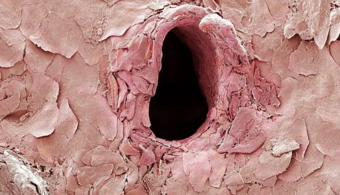 Ось як виглядає дірка в шкірі після того, як її проколює голка