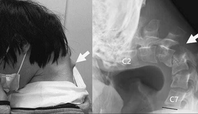 Клінічний випадок з Японії