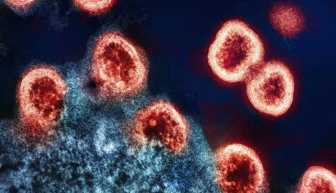 Частинки вірусу ВІЛ-1