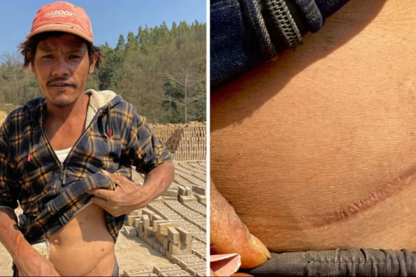 Трансплантация