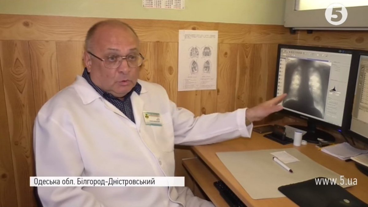 Лікар з туберкульозом