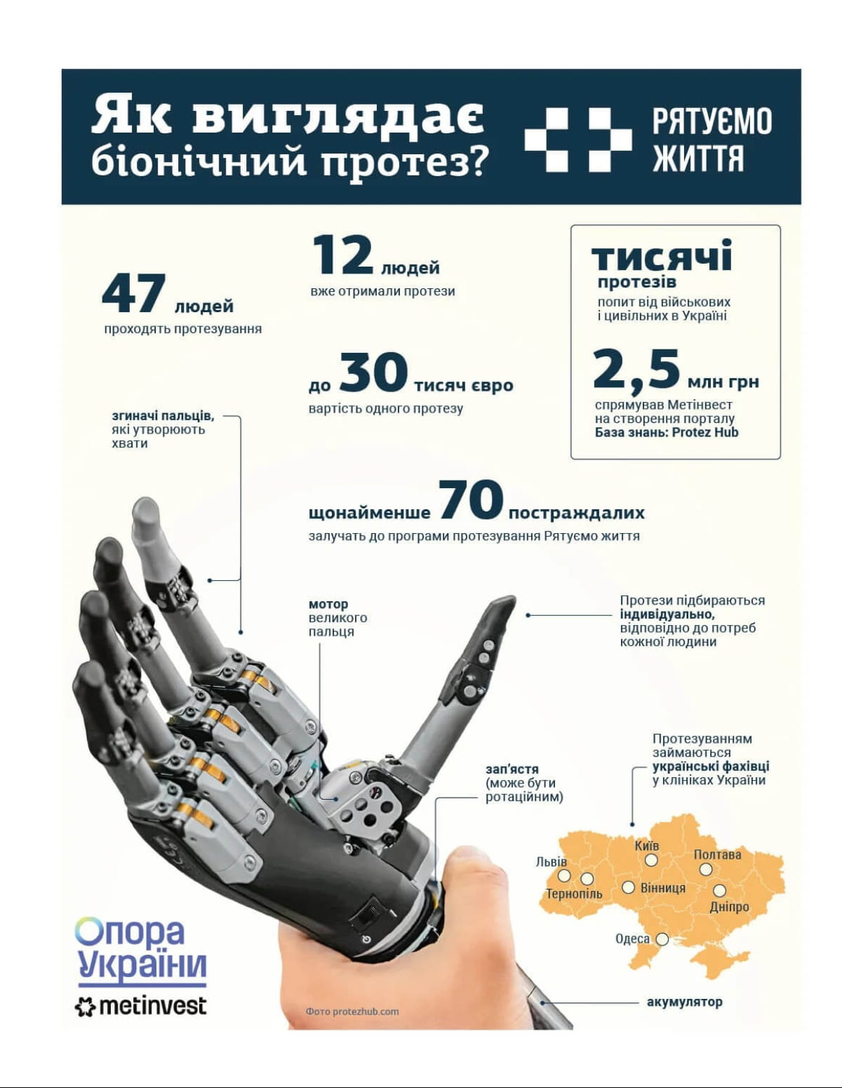 протезирование