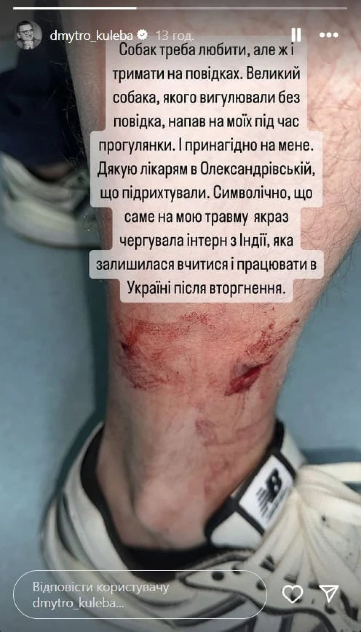 Голову МЗС Кулебу на вулиці покусав пес